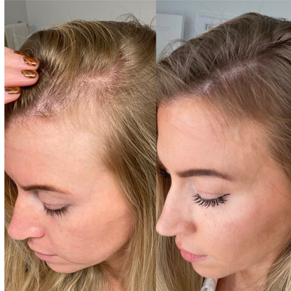 Alua™ Kollagenprotein