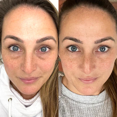 Alua™ Kollagenprotein